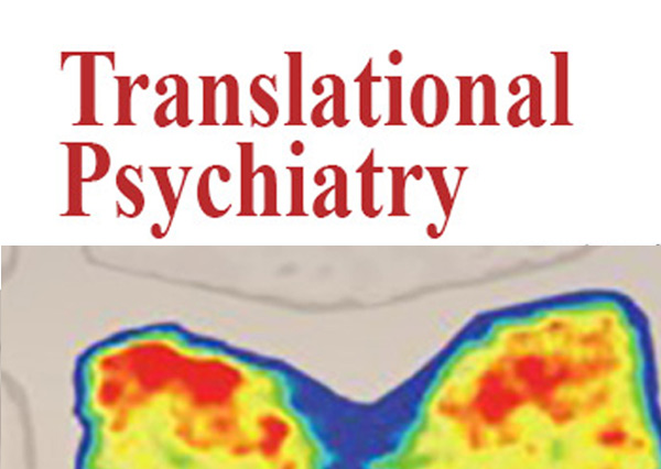 Intravenous immunoglobulin for the treatment of autoimmune encephalopathy in children with autism