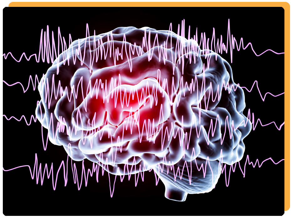 Why am I still having seizures while on medication?