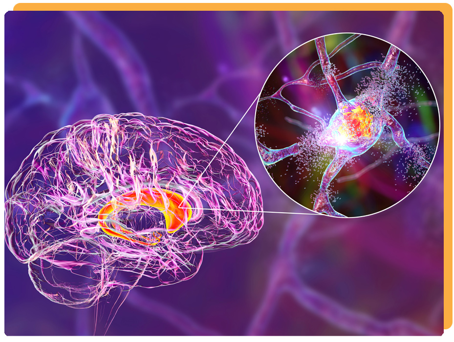 Basal Ganglia Encephalitis